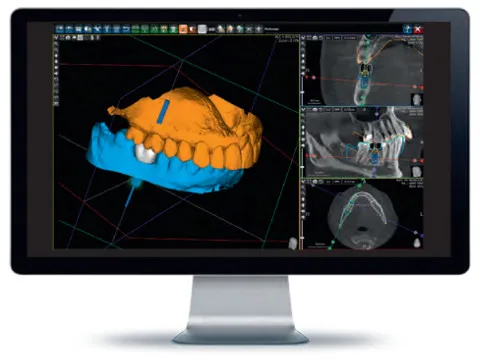 3D-R&ouml;ntgentechnik